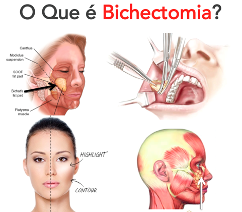 bichectomia-well-being-dr-sampaio